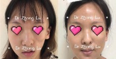 大小脸怎么拍摄视频教程
